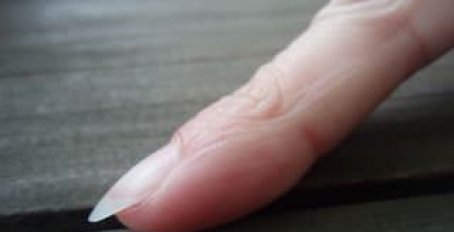 Как вытащить занозу из пальца безопасно и безболезненно