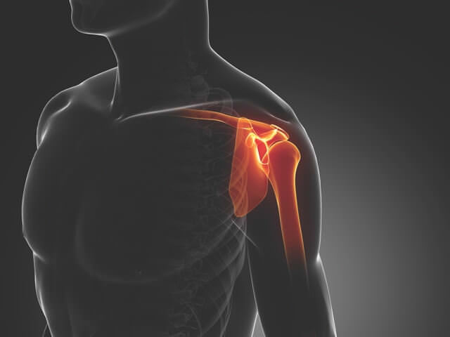 Разрыв связок плечевого сустава симптомы