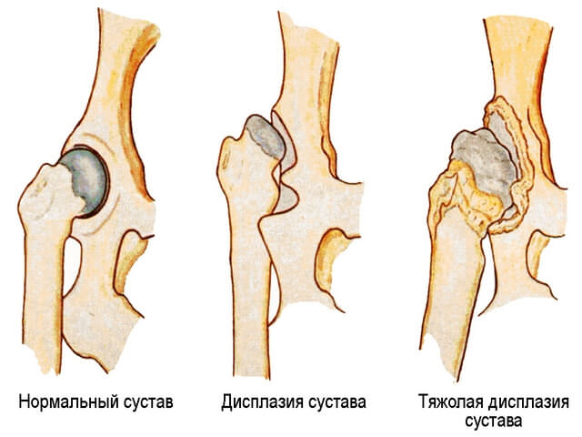 Изображение - Массаж при артрозе тазобедренного сустава Massazh-tazobedrennogo-sustava3