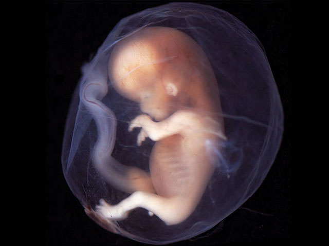 Эмбрион человека 